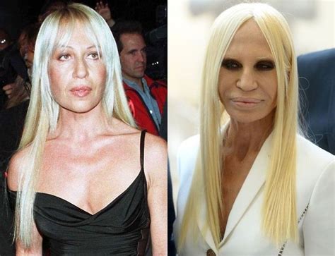 Donatella Versace without plastic surgery